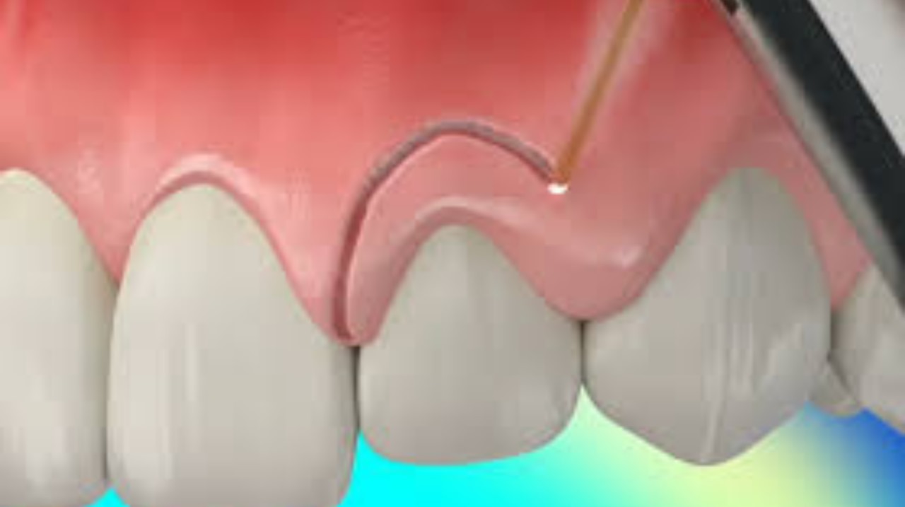 Post Thumbnail